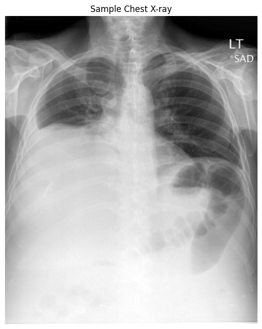 Sample chest X-ray image showing the ribs, spine, heart, and lungs. Source: https://openi.nlm.nih.gov
